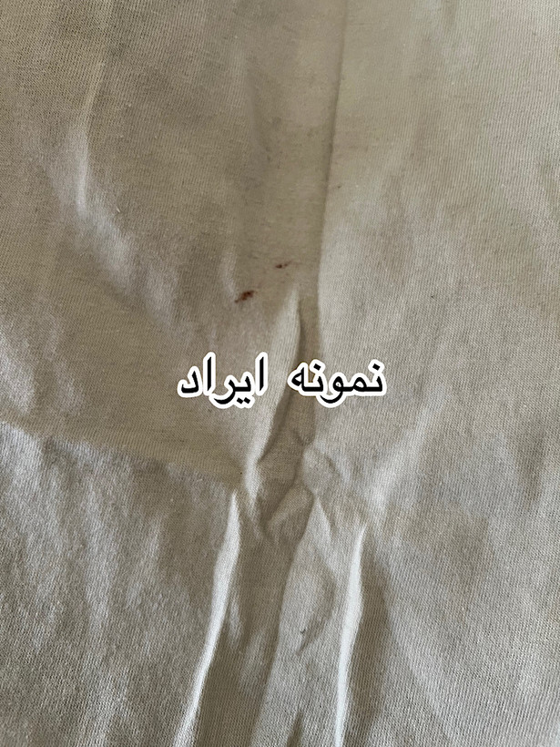 تیشرت یونیسکس قورباغه(ایراددار)
